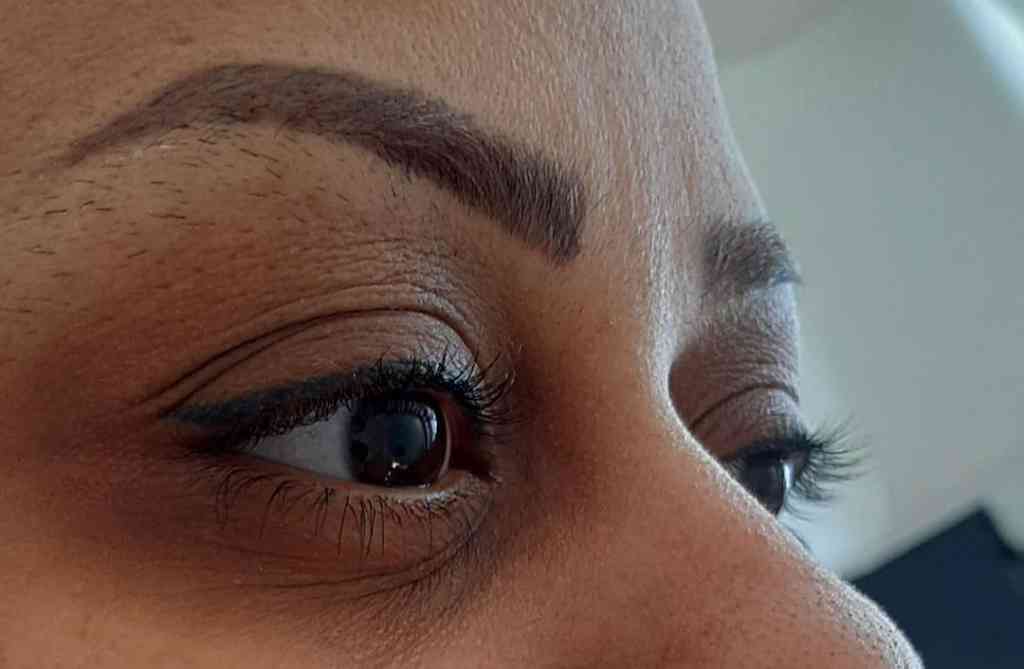 کاشت مژه 5 کاشت مژه قبل